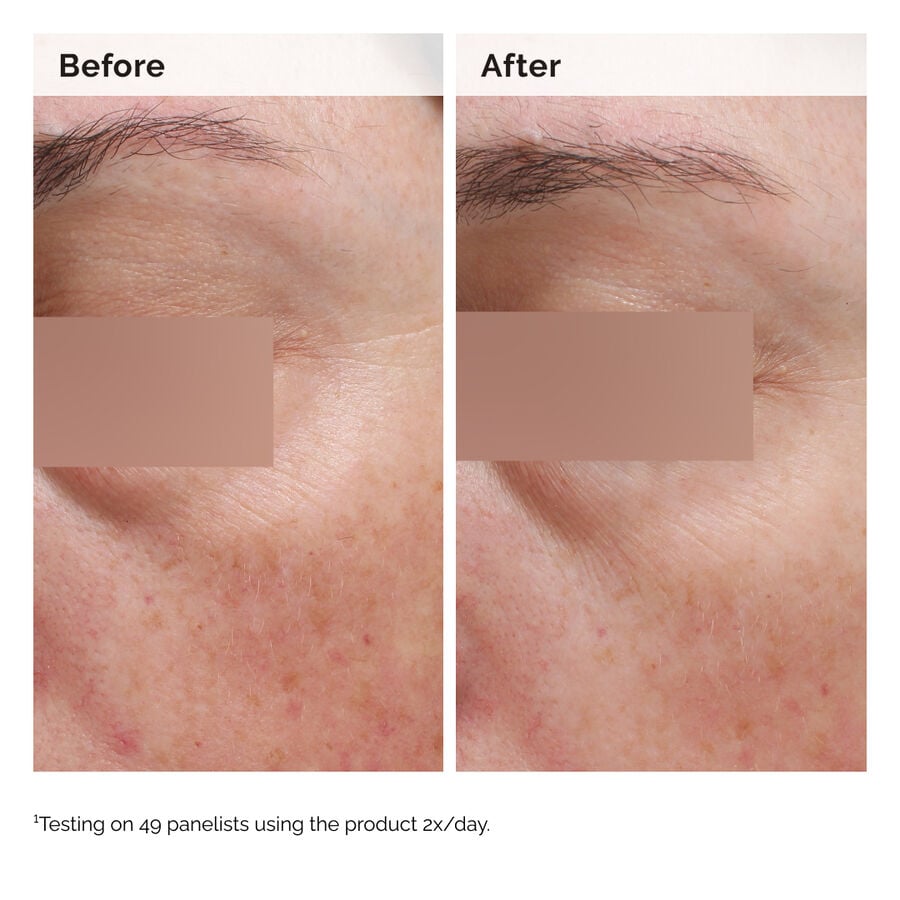 niacinamide-5-face-and-body-emulsion-k3 2024-08-23-ORD-Nia-5pct-Face-Body-B-A-Elasticity-Global-02-1x1.jpg