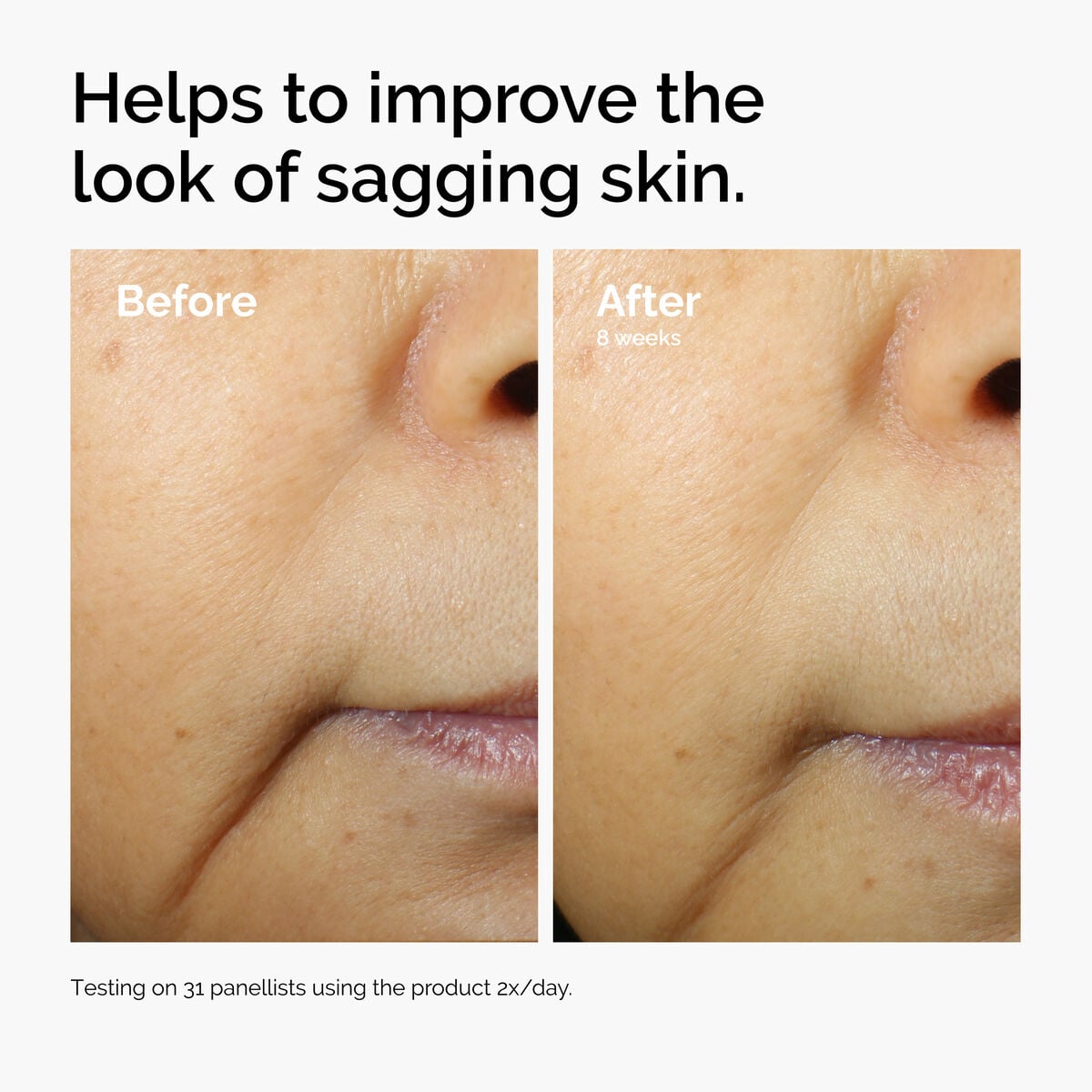 caffeine-3-escin-1-face-serum-g9 ord-caffeine-3pct-escin-1pct-face-serum-before-after-sagging.jpg