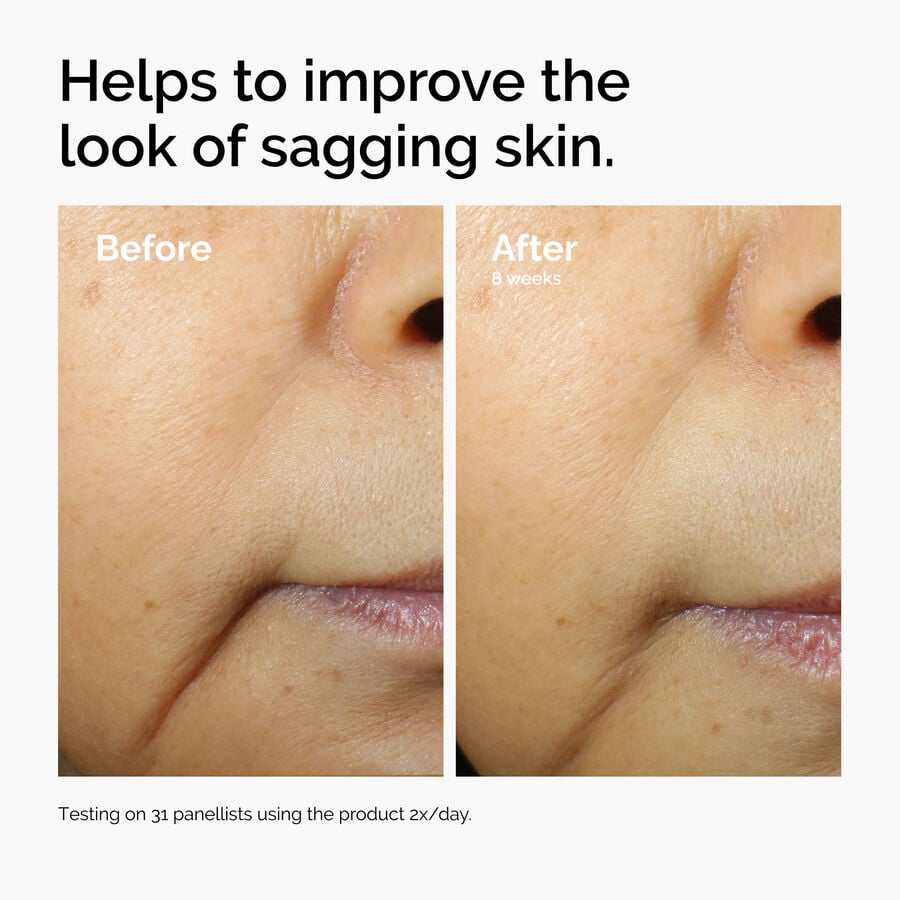 caffeine-3-escin-1-face-serum-g9 ord-caffeine-3pct-escin-1pct-face-serum-before-after-sagging.jpg