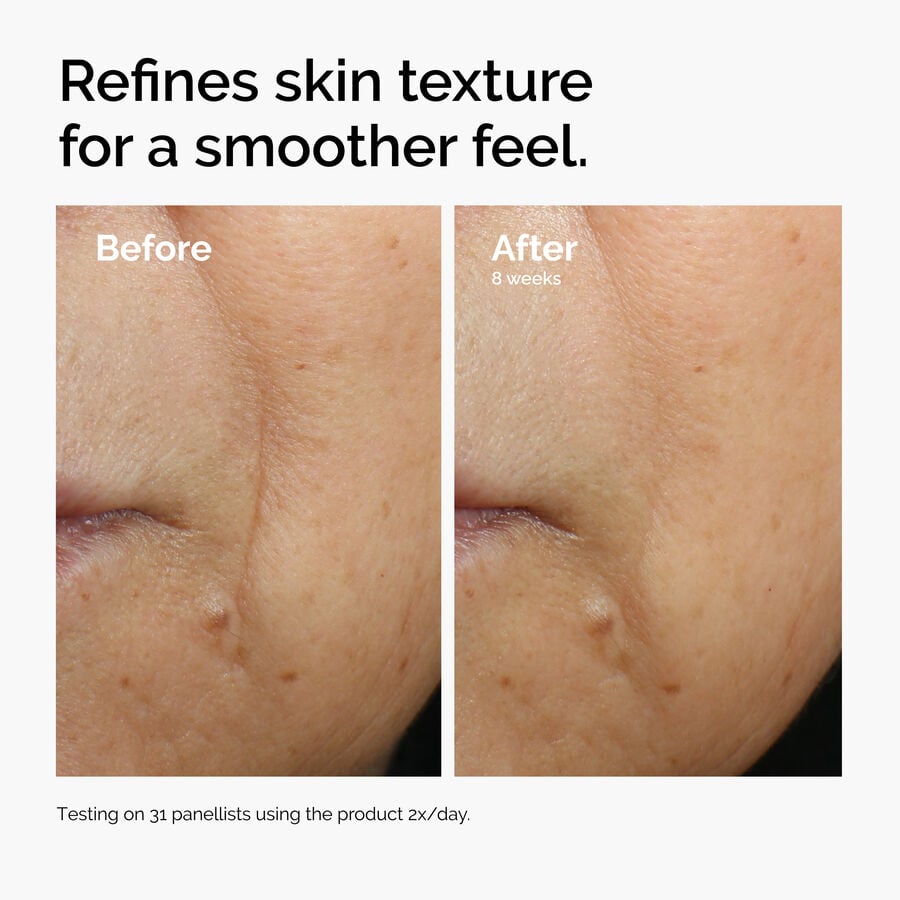 caffeine-3-escin-1-face-serum-g9 ord-caffeine-3pct-escin-1pct-face-serum-before-after-texture.jpg