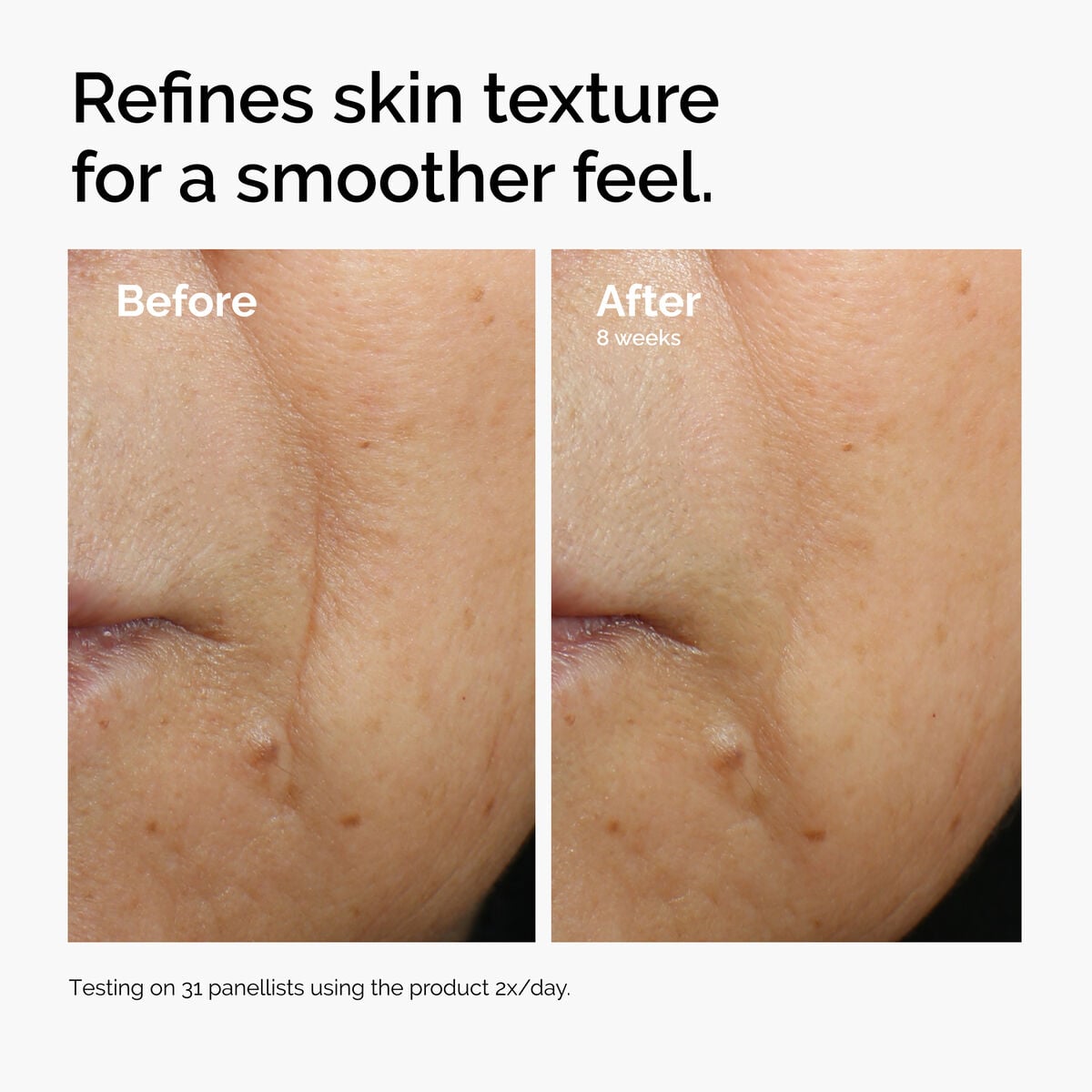 caffeine-3-escin-1-face-serum-g9 ord-caffeine-3pct-escin-1pct-face-serum-before-after-texture.jpg