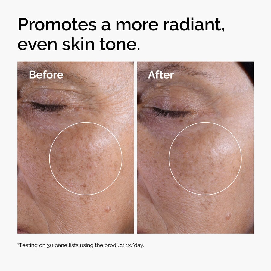 glycolic-acid-7-exfoliating-toner-s6 ord-glycolic-before-after-radiance.jpg
