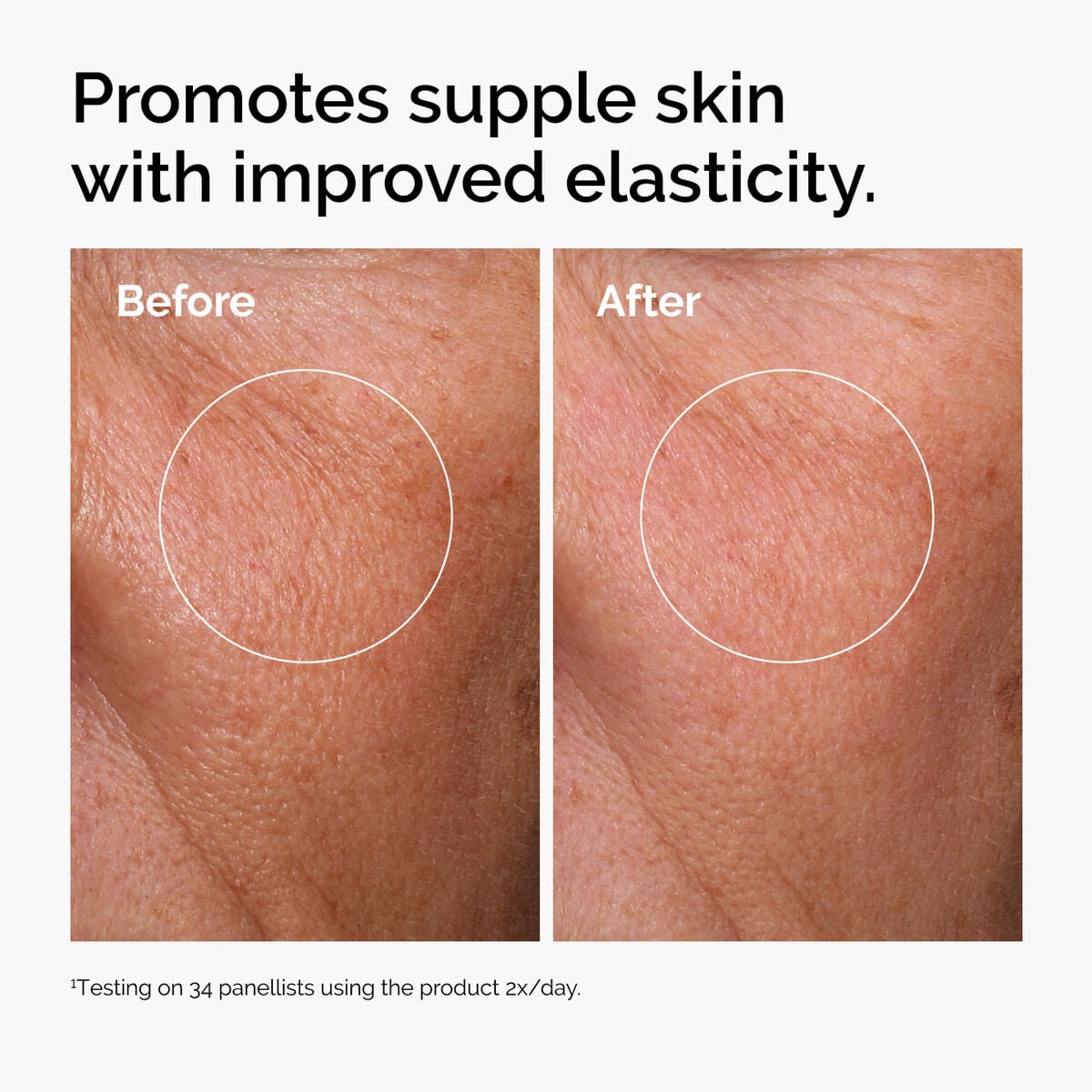 hyaluronic-acid-2-b5-with-ceramides-h4 ord-hyaluronic-acid-2pct-b5-hydrating-serum-before-after-elasticity.jpg