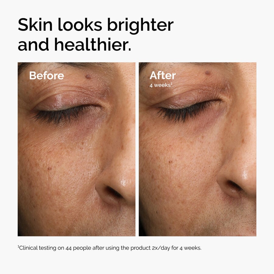 multi-antioxidant-radiance-serum-u6 ord-mars-before-after-healthy.jpg