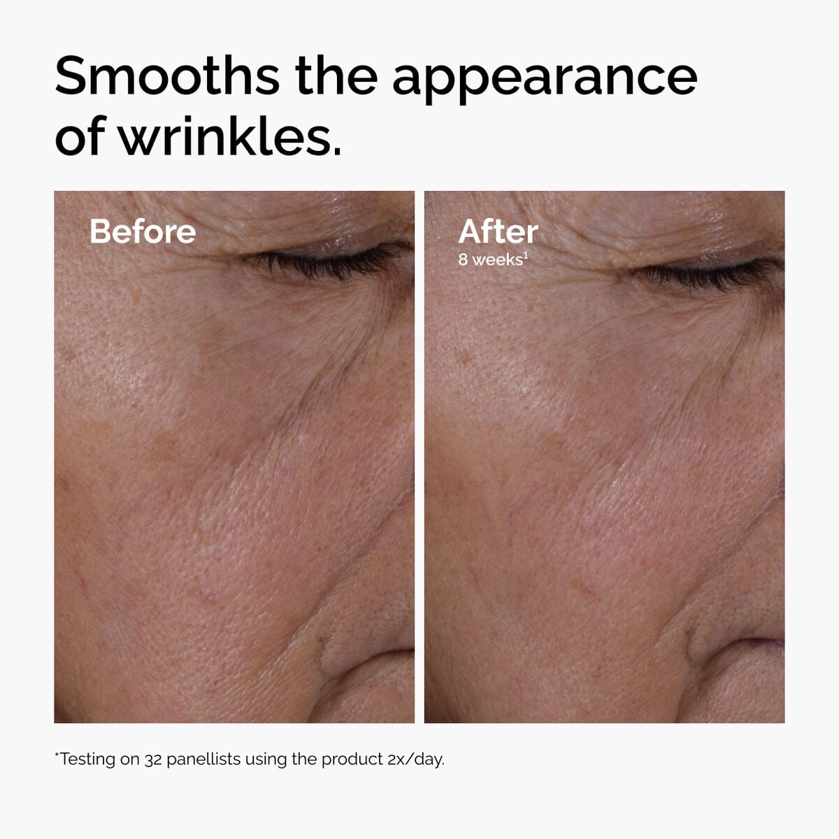 multi-peptide-ha-serum-r4 ord-multi-peptide-ha-serum-wrinkles-before-after.jpg
