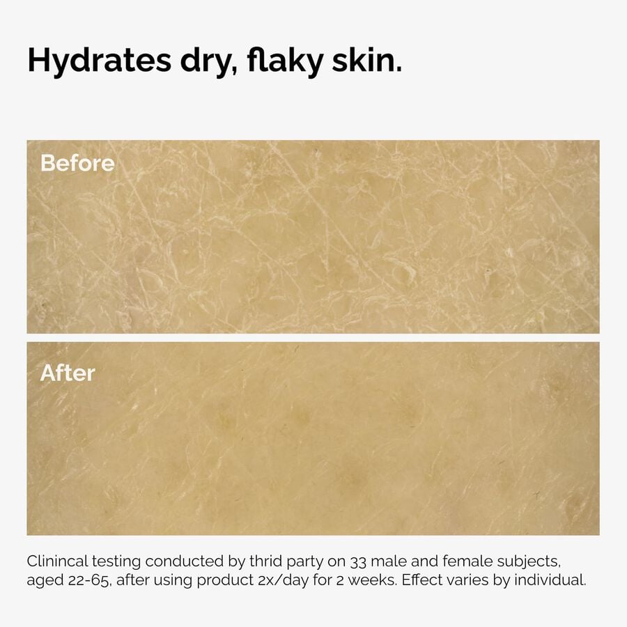 the-body-care-collection-v8 ord-natural-moisturizing-factors-inulin-body-before-after-graphic-02.jpg