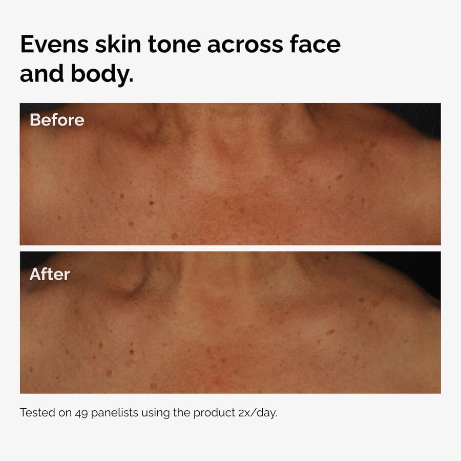 the-body-care-collection-v8 ord-niacinamide-face-body-serum-before-after-even-tone-graphic.jpg