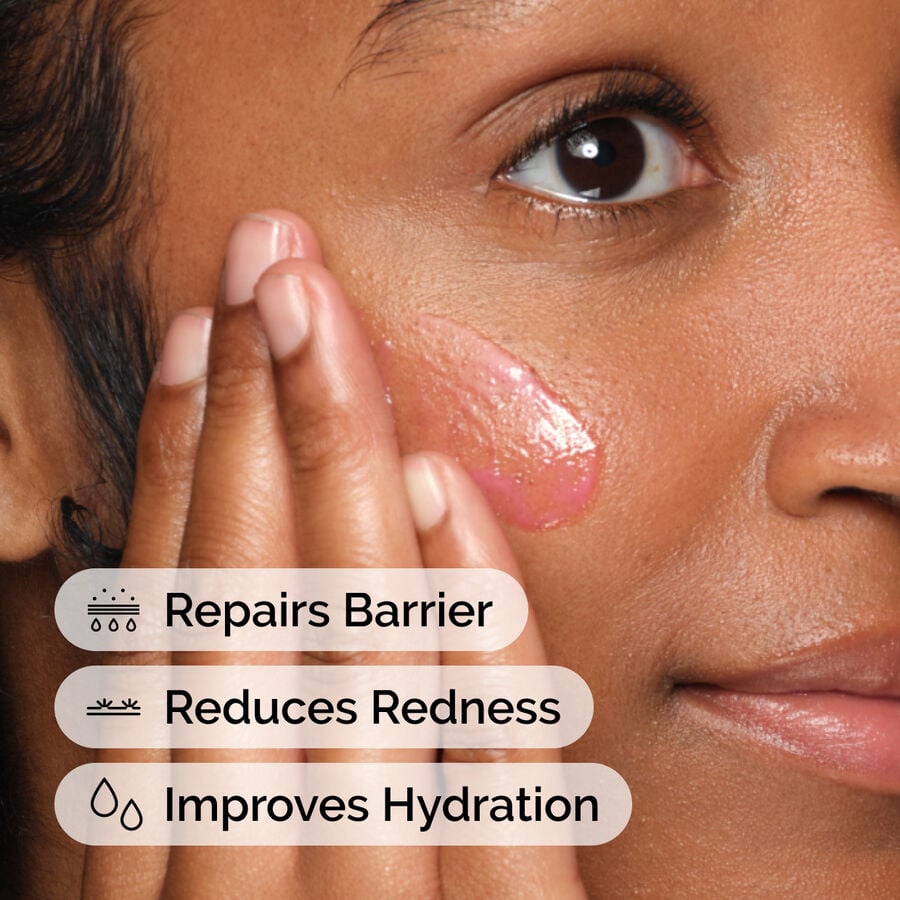 soothing-and-barrier-support-serum-y4 ord-soothing-barrier-support-serum-model-application-with-benefits.jpg